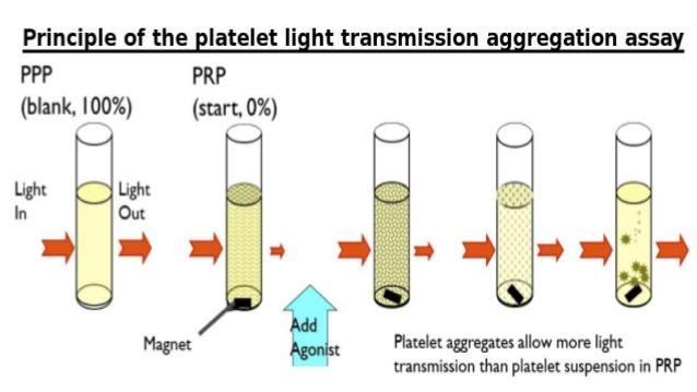 Light transmission platelet aggregometry Platelet