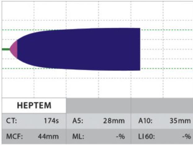 HEPTEM compare with INTEM INTEM CT long HEPTEM CT normalization > Heparin