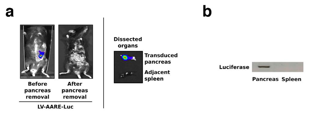 Supplementary Figure 5 Assessment by bioluminescence imaging of the lentivirus dissemination in the mouse body following pancreatic transduction with LV- AARE-Luc.