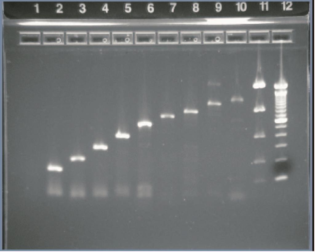 Determining RNA Quality and Quantity, Continued Example Results The quality of total RNA obtained from FFPE mouse brain tissue using the PureLink FFPE Total RNA Isolation Kit was tested by RT-PCR