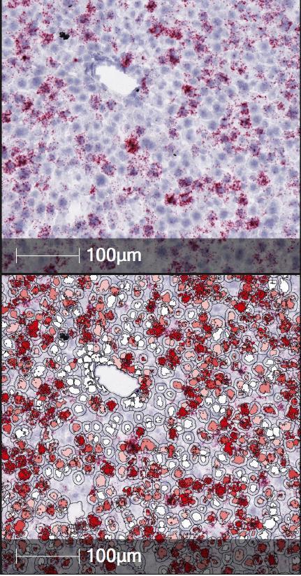 (FIX)-expressing hepatocytes with BaseScope TM method Hybrid malb-f9