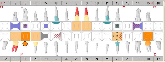 Odontogram displays: Initial findings- existing restorations, caries, conditions