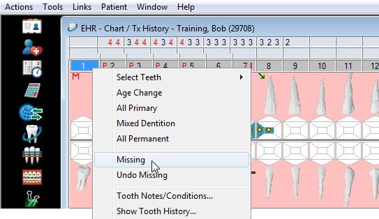 ***1st step to charting: Select teeth