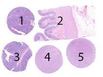 Assessment Run 53 2018 B-cell specific activator protein (BSAP, PAX5) Material The slide to be stained for BSAP comprised: 1. Tonsil, fixed 24h, 2. Colon, 3. Tonsil, fixed 48h, 4.