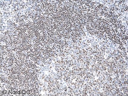 , DAK-Pax5), both as a Conc format and an RTU system tailored to a specific IHC platform may account for the overall increase in sufficient results.