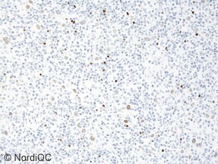 (negative staining reaction), show a moderate to strong, distinct nuclear staining reaction. Fig.