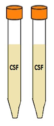 CSF Preparation Processing Step One Step Two Step Three Step Four Step Five Step Six 1.0 ml X 10 Collect CSF into the 3 ml luer lock syringe or by gravitational pull. Dispense 1-2 ml in a cryovial.