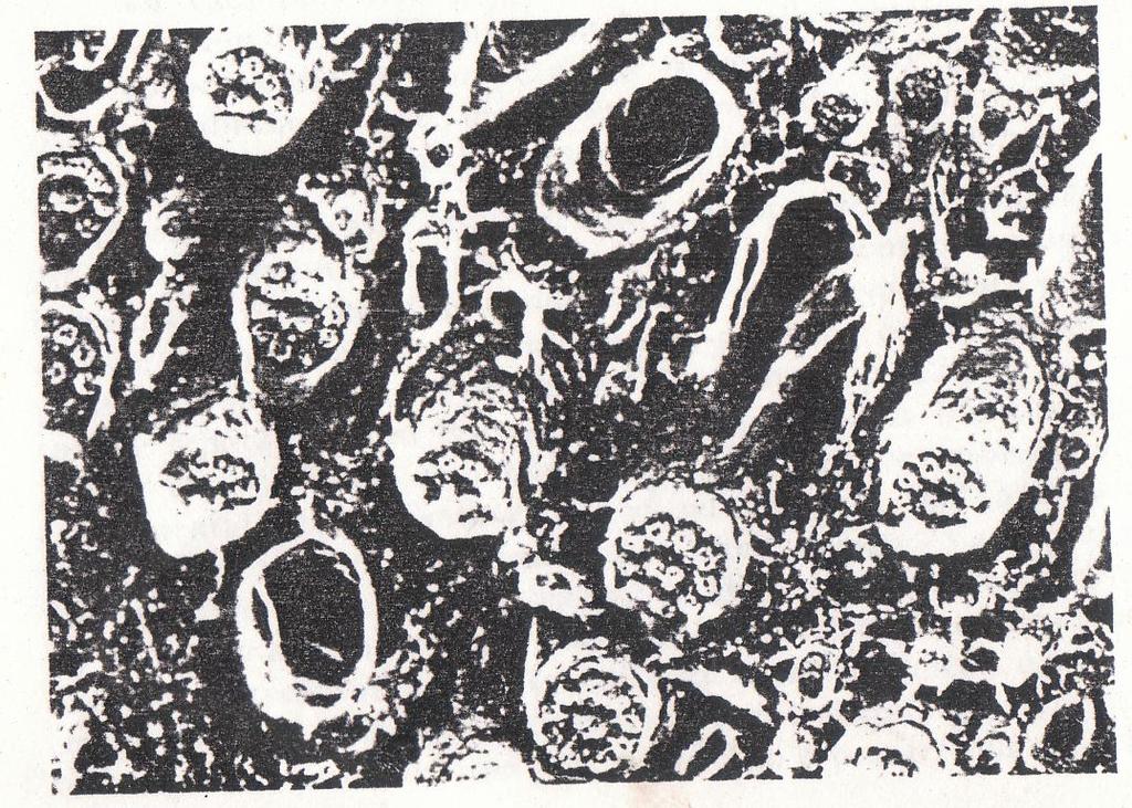 Morphology of some bacteria as seen under the microscope [Source: Bergey s Manual of Systematic Determinative