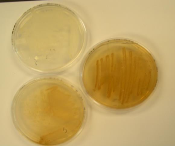 Pigment Producing Microbes in Soil a Soil Assay b Control Tyrosine We were able to stimulate production of a dark pigment in soil after addition of tyrosine (a).