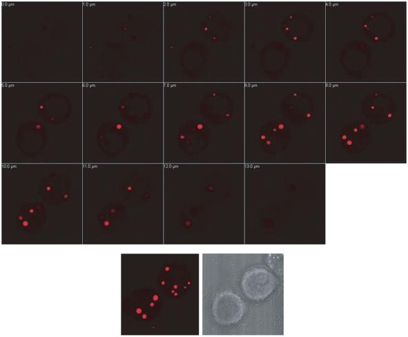 6 M. Raychaudhuri and D. Mukhopadhyay / Grb2-Mediated AICD Trafficking A B Supplementary Figure 6. Grb2-DsRed containing vesicles at different Z-sections of the cell.