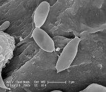 mineral composition & size Mineral composition affects bacteria in other