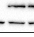 levels of hzip4-ha weree detected using anti-ha antibody and