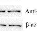 β-actin as loading control; (bottom)
