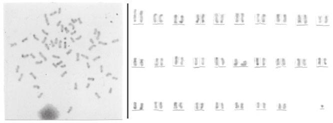 A Karyotypic characterization of Iheringichthys labrosus 665 Figure 1. Somatic metaphase and karyotype of Iheringichthys labrosus after C-banding (A) and after treatment with AluI ().