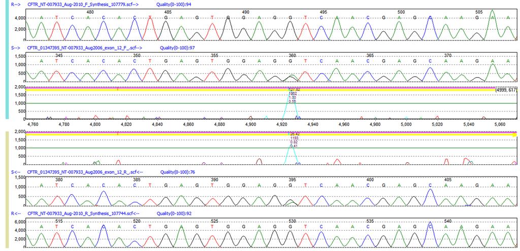 Accuracy & Sensitivity Anti-Correlation Technology: Mutation Surveyor software uses an anti-correlation technology which compares sample sequences to a reference sequence.