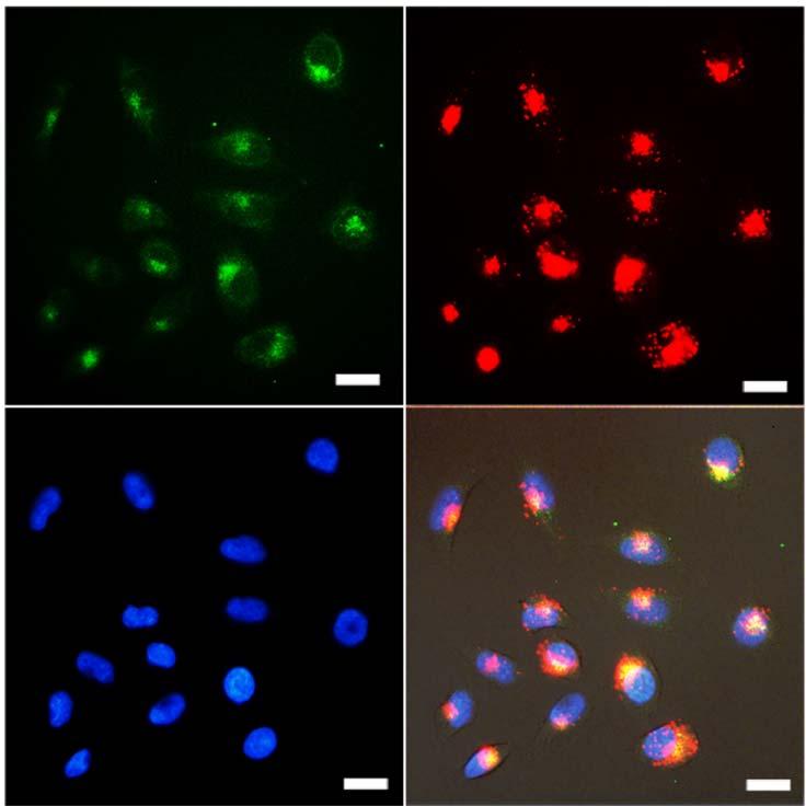 Supplementary Figure 22. Co-localization images of MnO2@PtCo nanoflowers in 4T1 cells.