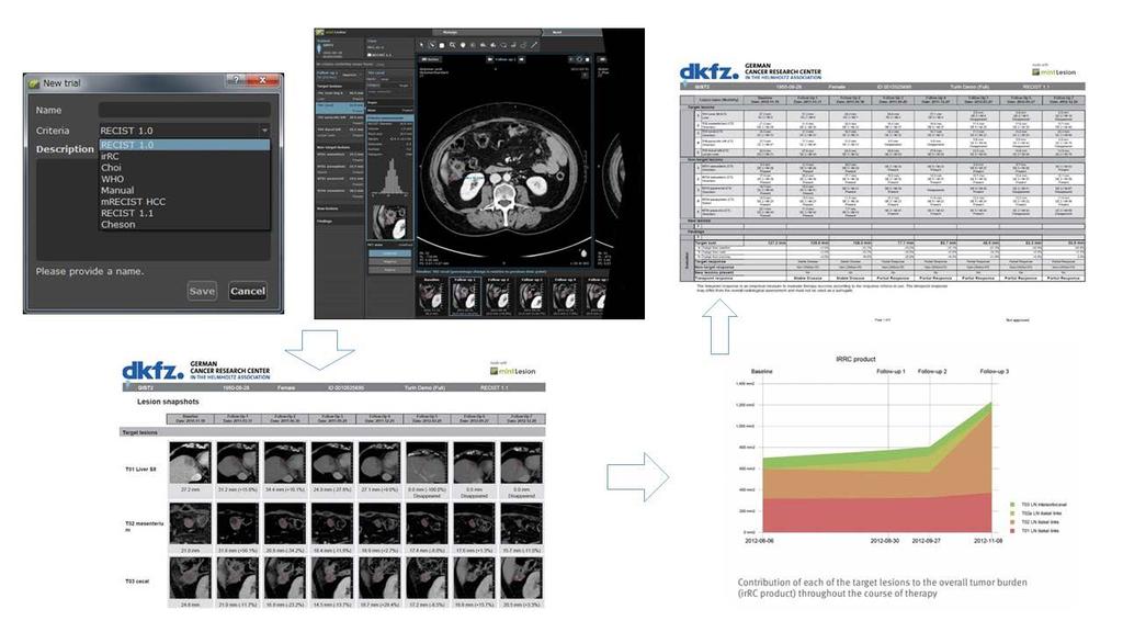 LISIT Comprehensive Support Clinical Trials (Imaging CRO service) One of workflow sample for imaging clinical trials Smarter and Fast Processing Workflow for Imaging CRO and support imaging clinical