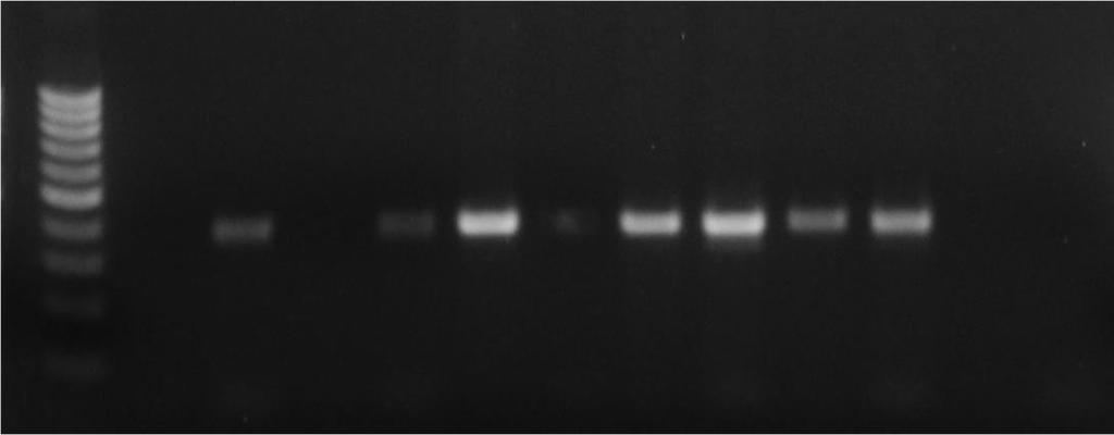C. Analyzing the Gel 1. Print out a copy of the picture of the DNA gel. 2. Label each lane appropriately.