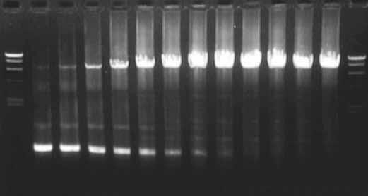 Results: Gradient PCR with TaKaRa PCR Thermal Cycler Dice (Gradient Model) Results for Shuttle PCR 2 step PCR annealing/extension temperature 52 C 72 C M (gradient) M Results for Conventional PCR 3