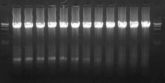 RT-PCR was performed both with and without AMV RTase XL in the reaction mixture.