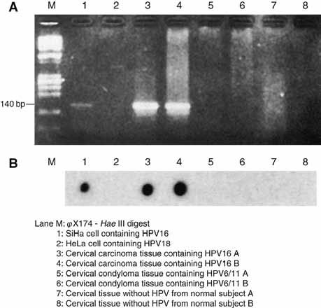 often found in cervical carcinoma. This primer set allows simple and sensitive detection of HPV 16, 18 or 33 by specific amplification of their DNA using PCR.