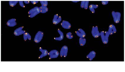 Figure 16.21 elomeres in Mouse hromosomes 1 µm elomerase If chromosomes of germ cells became shorter in every cell cycle, essential genes would eventually be missing from the gametes they produce!