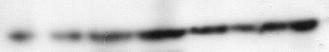 (A) A western blot of RNAi-induced cultures of TbE6 shown in Fig. 4A were probed with the anti-pap reagent that detects the protein A component of the PTP tag.