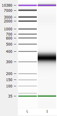 Sample Bioanalyzer trace: A) B) High Sensitivity DNA Chip Output: A) NEXTflex 1 µg, 6 cycle PCR product, 300 bp read (gel
