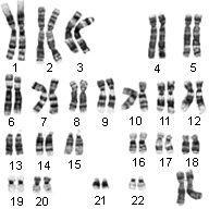 What is a mutation? What would happen to this sequence if a point mutation occurred in the DNA changing the second G to an A? What if that G was simply deleted?