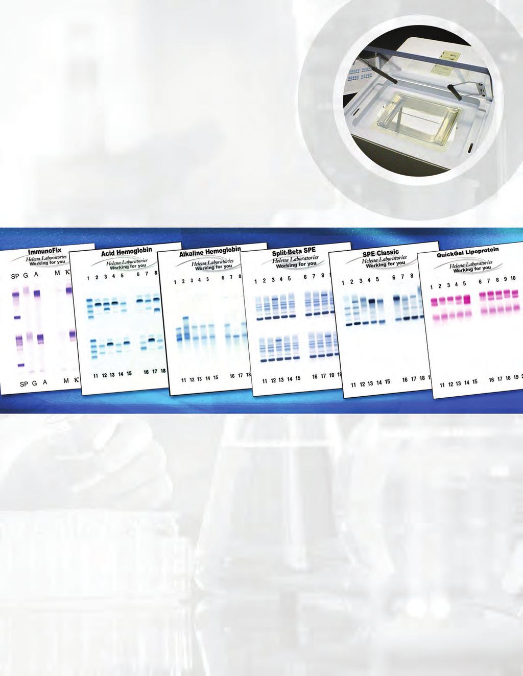 QuickGel Manual Electrophoresis QuickGel electrophoresis products are compact and easy to use, allowing cost-effective manual separations without sacrificing quality or accuracy.