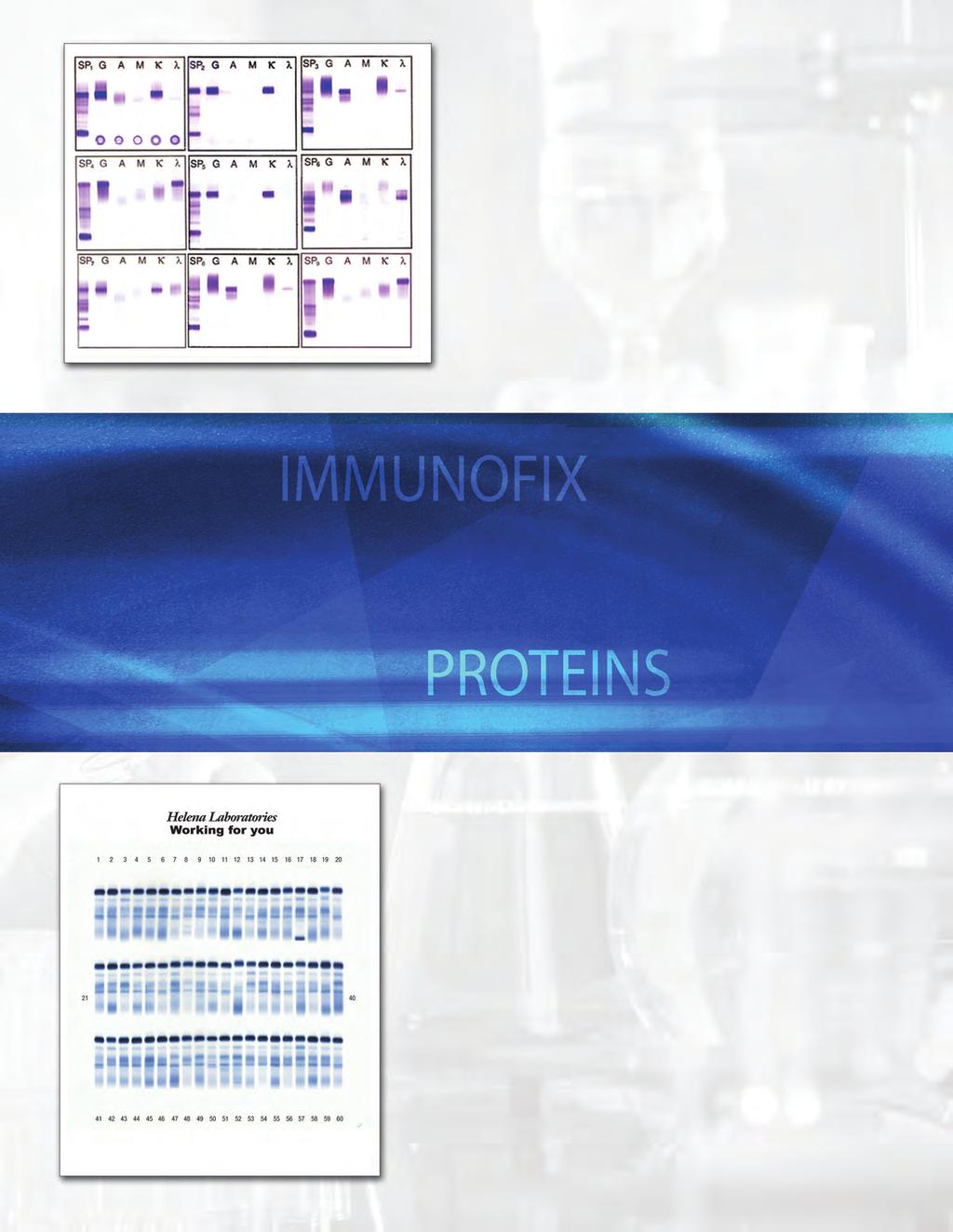 SPIFE ImmunoFix 1, 2, 3, 6, 9 and 15 sample gels to handle a wide range of needs; maximum throughput of up to 210 profiles in an 8-hour shift Multi-channel pipetting simplifies application of