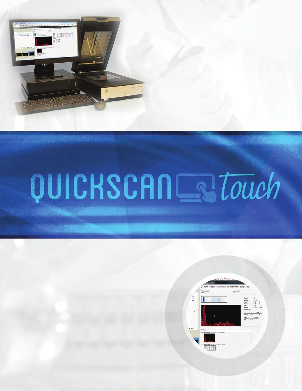 QuickScan Touch Touch the screen and automatically demarcate the M-spike. Swipe the slider and reverse the pattern image for easier analysis.