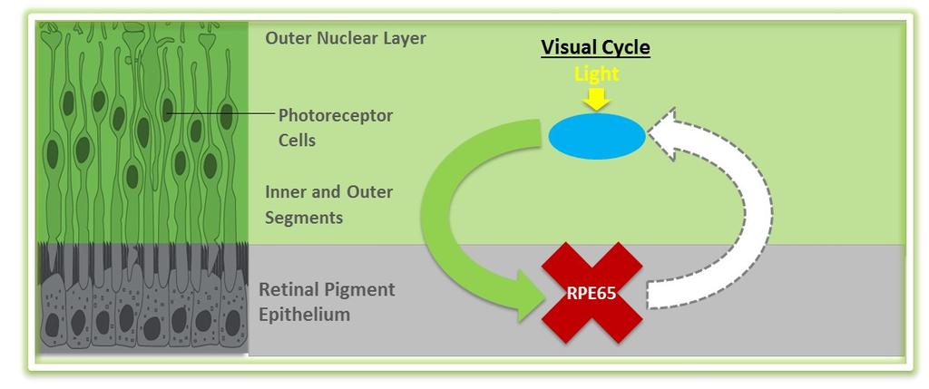 IRDs mediated by autosomal recessive RPE65 mutations RPE65 encodes a protein that helps convert light entering the eye into electrical signals that are transmitted to the brain Disease characterized