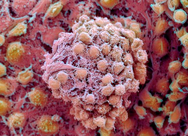 Human Embryonic Stem Cells Coloured scanning electron micrograph of