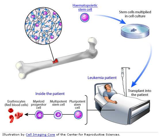 stem cells treat