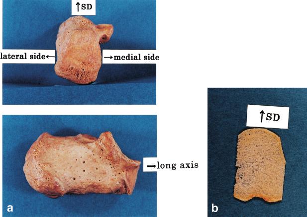 104 OSAKI ET AL. Fig. 1. a: Side and back views of left calcaneus bone. b: A slice sample (ca. 1.5 mm thick) used for the microwave measurements.