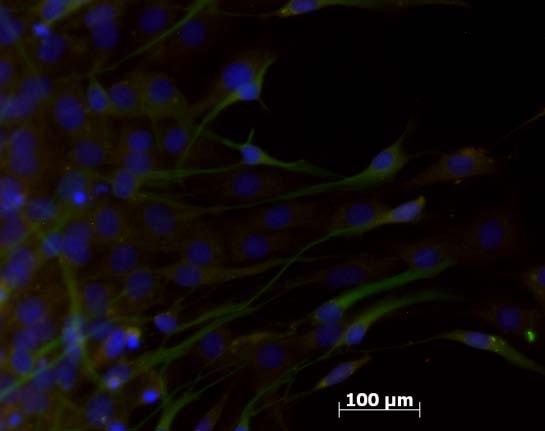 2 stem cell differentiation depends on the stiffness of