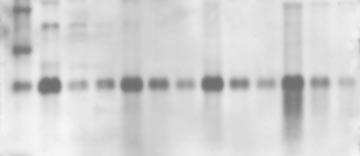 Typical result with the reagent Figure 20. Northern blot with total RNA isolated by the TriPure Isolation Reagent.