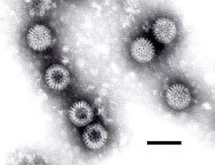 Rotavirus Rotavirus is commonly found in drinking water Rotavirus is known for being a global