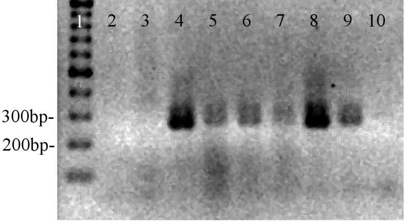 Colony 9 and 10 (lane 11 and lane 12) showed bands at ~4000 bp on the supercoiled ladder, indicating successful ligation with