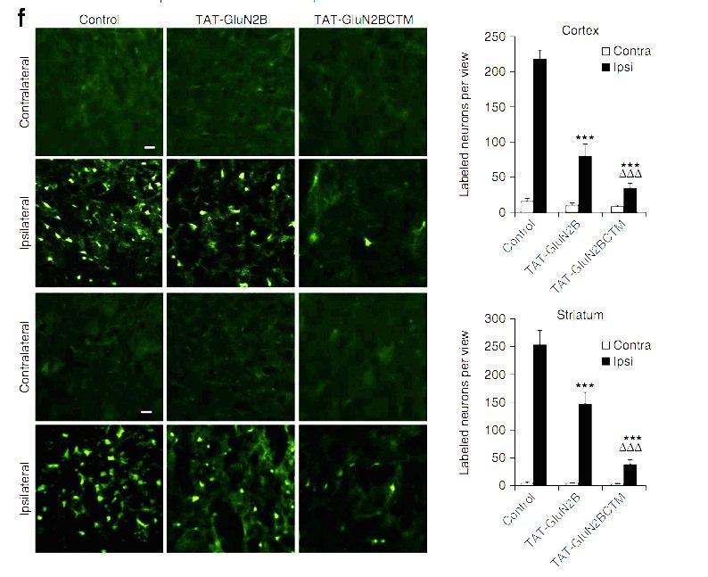 Neuroprotective effect of TAT-GluN2BCTM mediated knocks down of