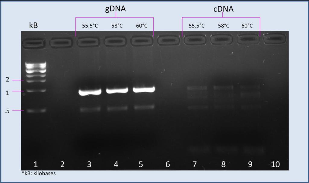 Figure 2 is a picture of an agarose gel. This one shows the results of the Polymerase Chain Reaction lab, as well as the purity of the DNA (indicated by the bright bands).