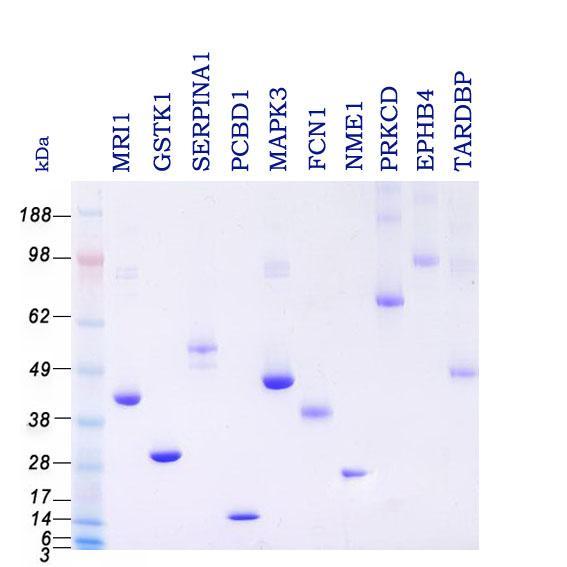 Full Length Human Proteins Produced from TrueORF cdna clones 5,000 full length human proteins Expressed