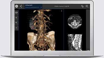 One platform for all modalities Key Features Cleared for diagnostic use 1 Quick and easy access to images within the EHR from any location, online or archived Server-side rendering with progressive