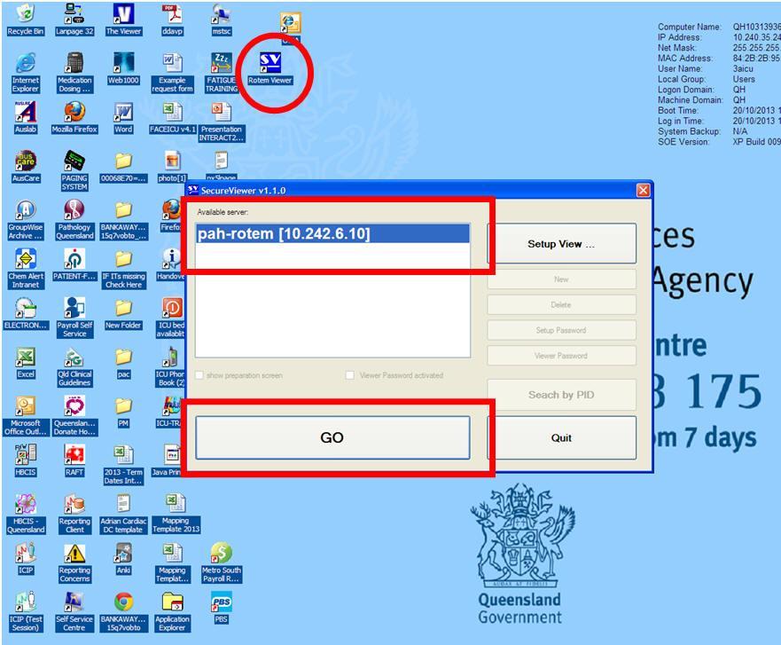 To view the results: Princess Alexandra Hospital Emergency Department Clinical Procedure 1. Open the Secure Viewer (SV) on the desktop of the computer in Resus 3 or 4 2.