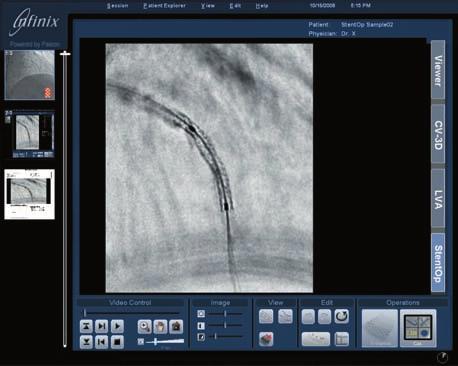 The combination of these technologies provides detailed anatomical 3D reconstructions and 3D image display for enhanced diagnosis and interventional