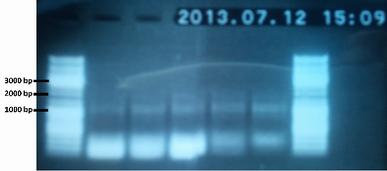 For this reason, the PCR reaction 3 step was performed again. New round!