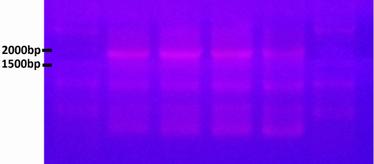 The Sixth PCR was run on an 1% agarose gel Using different amounts of both templates several