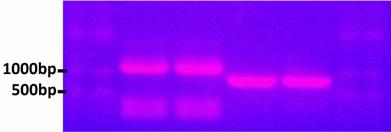 The two PCR two clear bands at the right lengths.