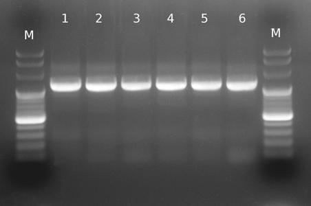 Fig. 1a. Fresh human blood RNA isolation results. Agarose gel electrophoresis of isolated total RNA. Isolation performed two hours after blood collection.